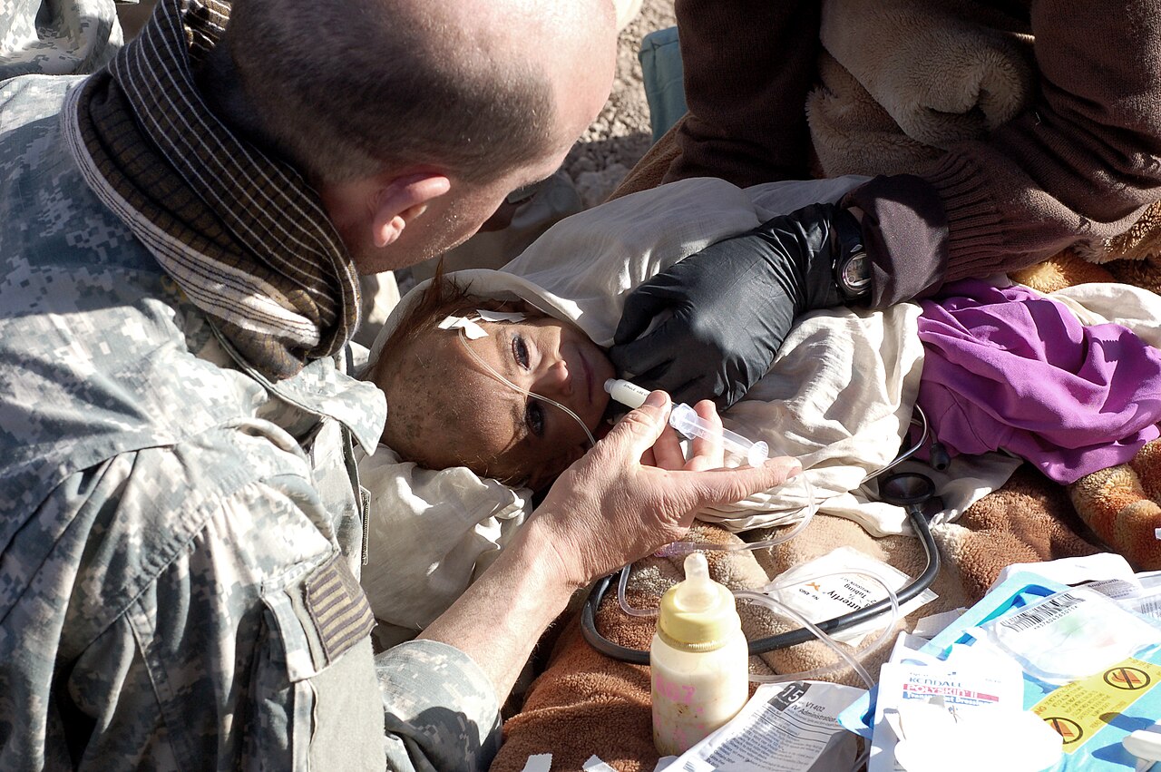 Foto fra Afghanistan – Malnurished Afghan Child